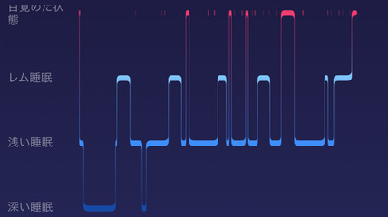 20170614_fitbit01-w1280